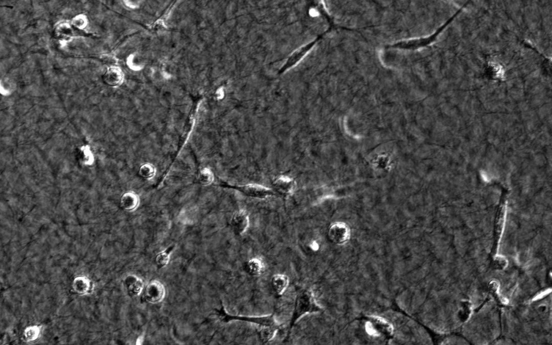 Does hyaluronan fragmentation affect cancer metastasis?